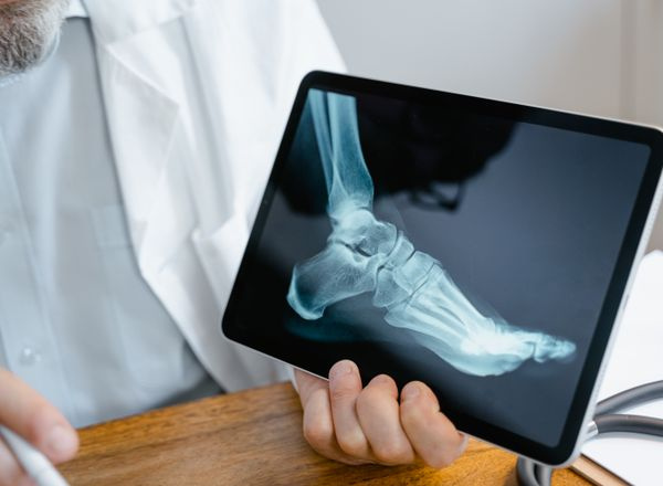 doctor examines x-ray image of a foot on tablet